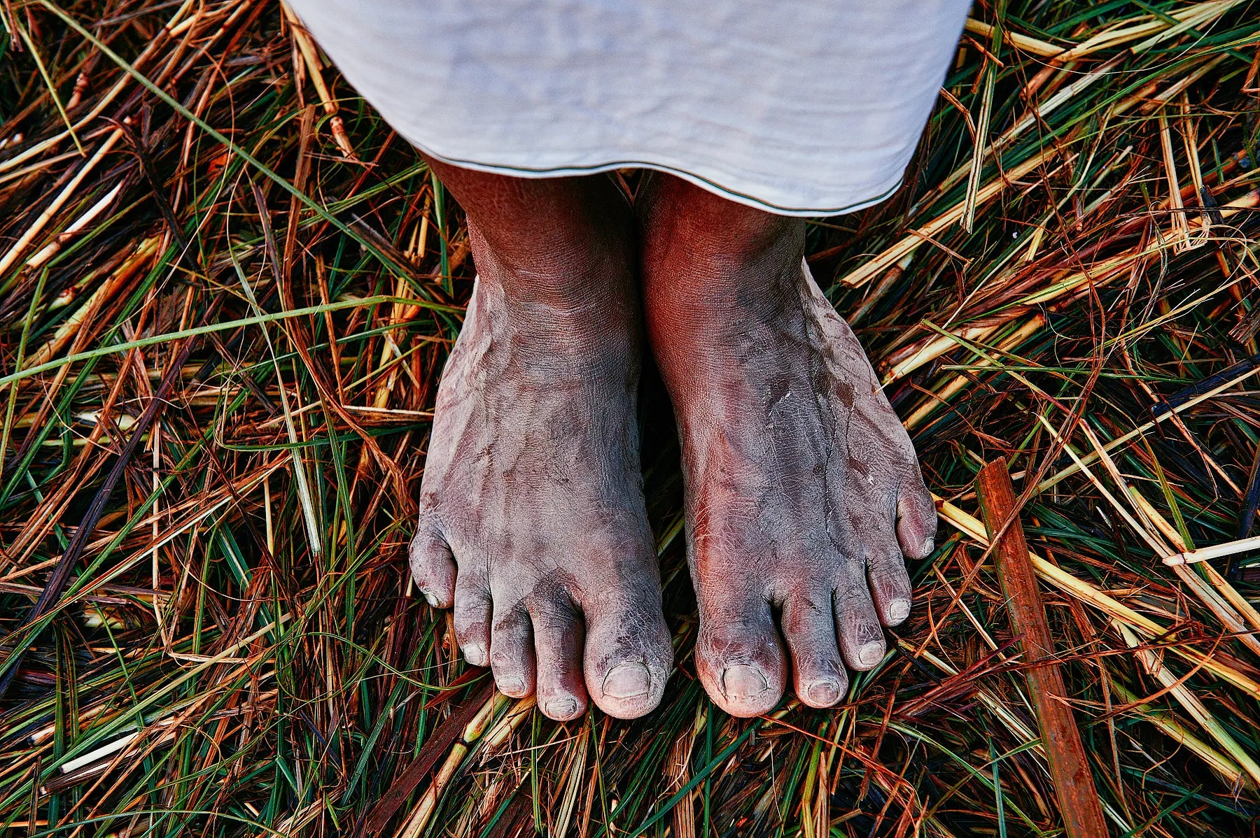 Feet I